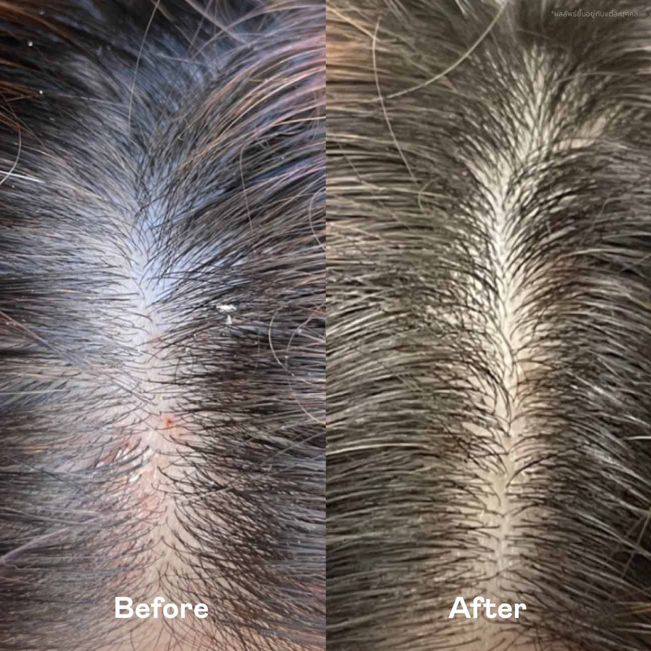 11.11 Black Friday Haircare Set