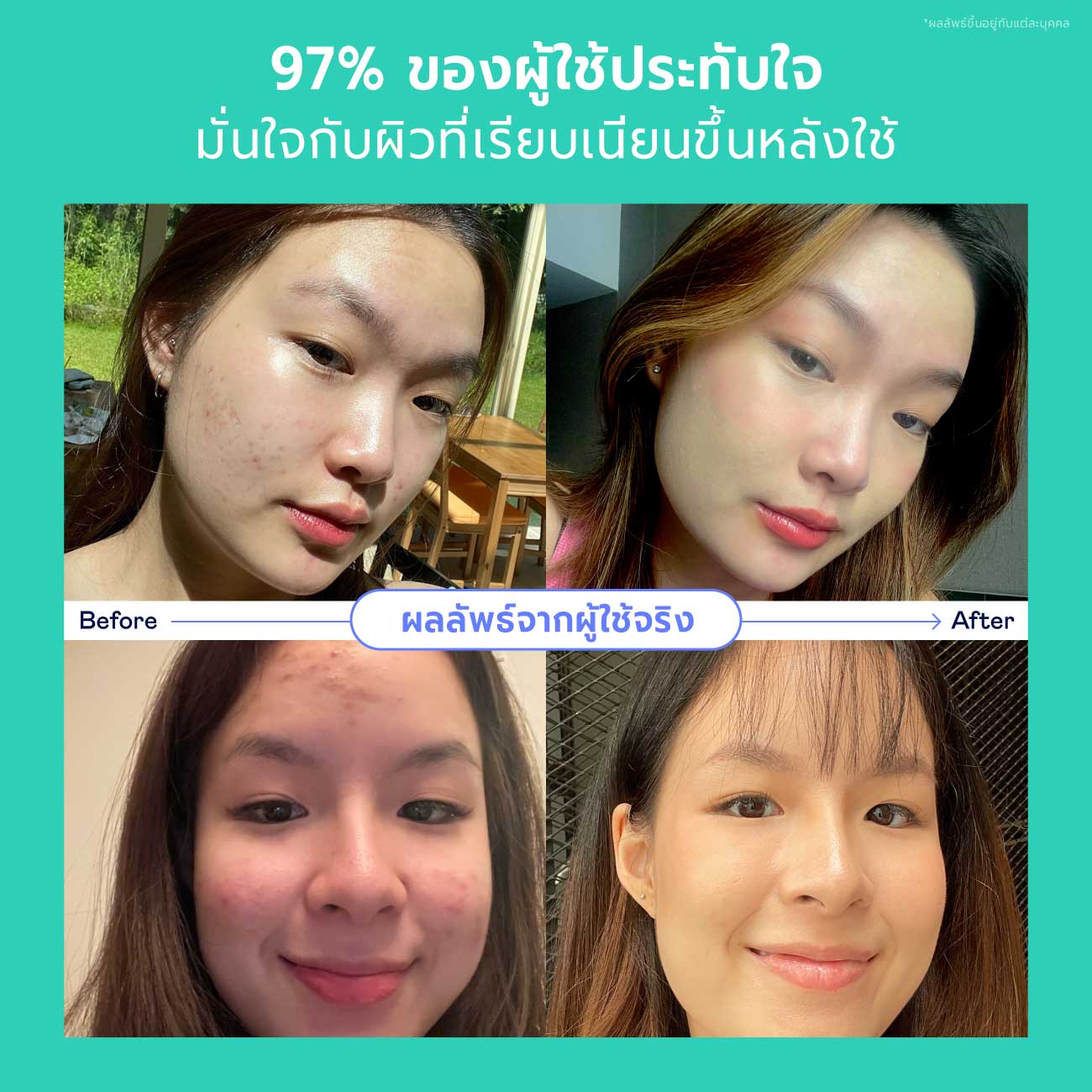 Chinese New Year Skincare Set