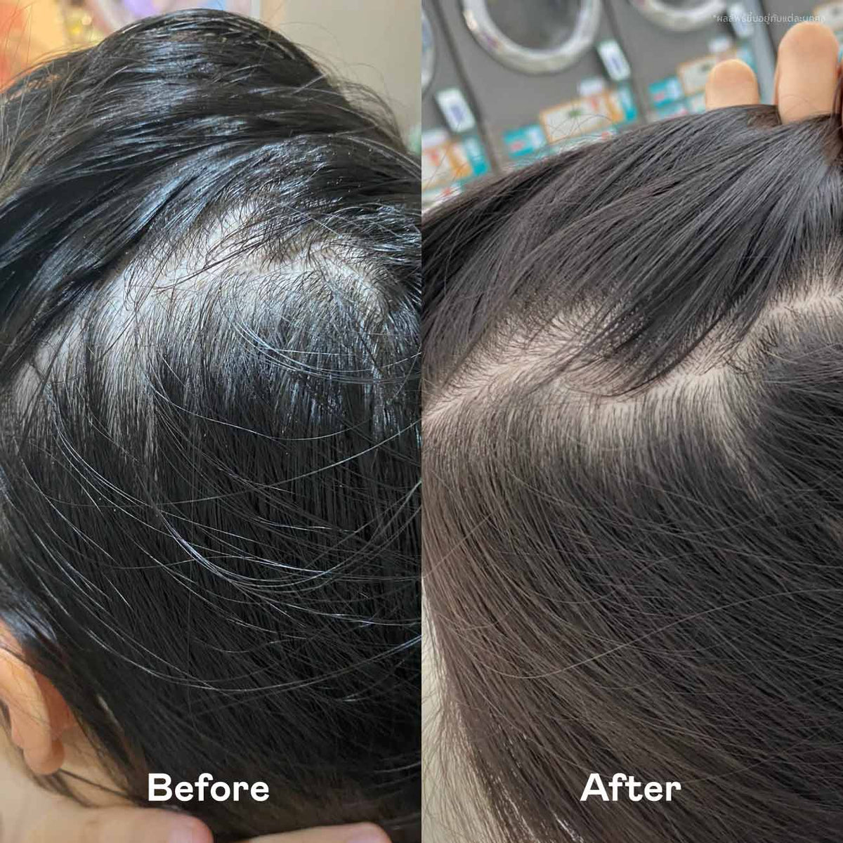 Scalp Routine + Serum