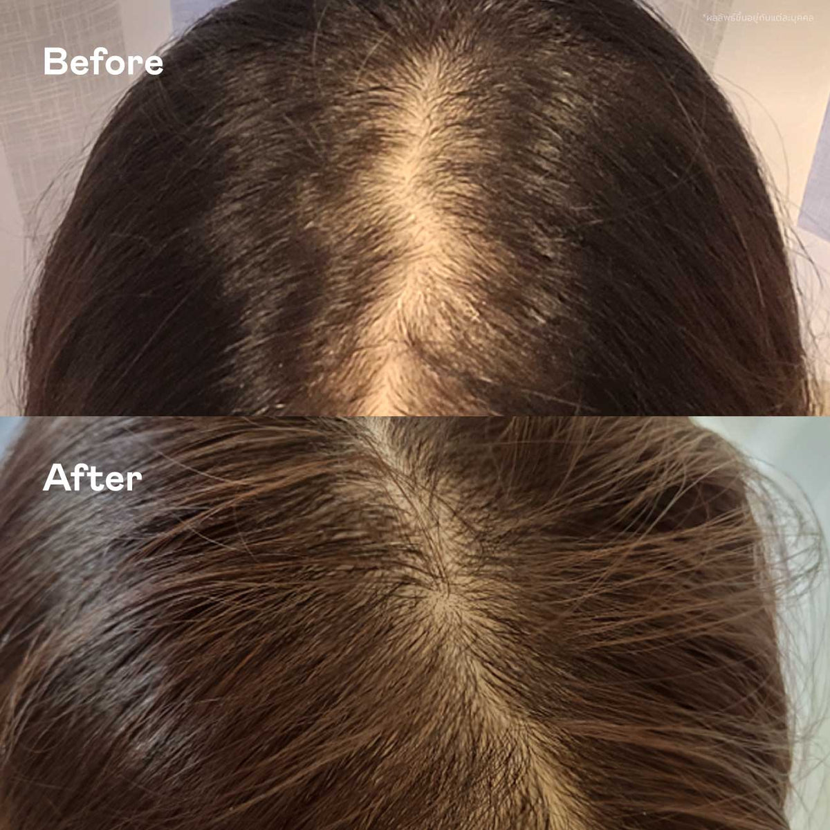 Scalp Routine