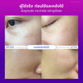 Birthday Anti-Ageing Set