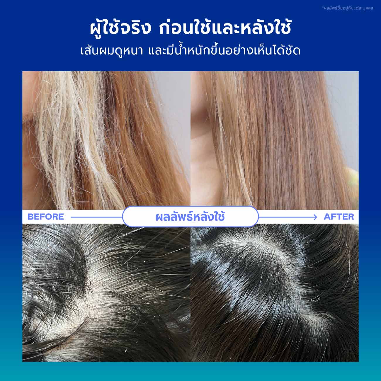 Birthday Haircare Set