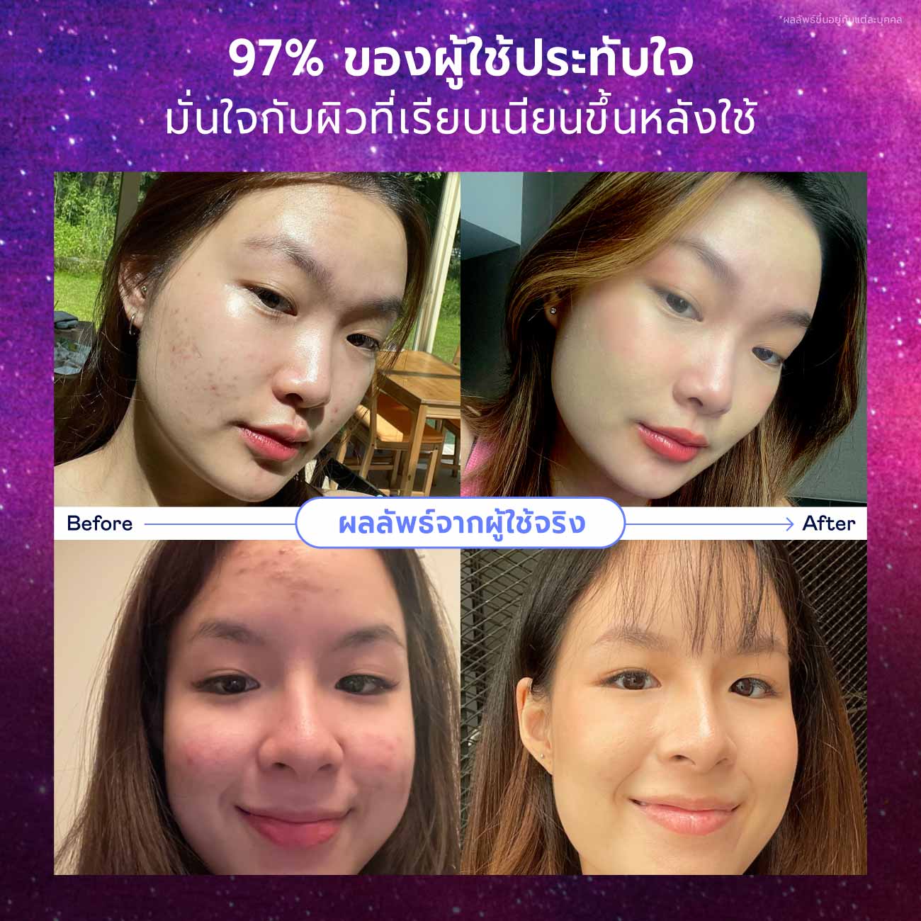 11.11 Skincare Promo Set