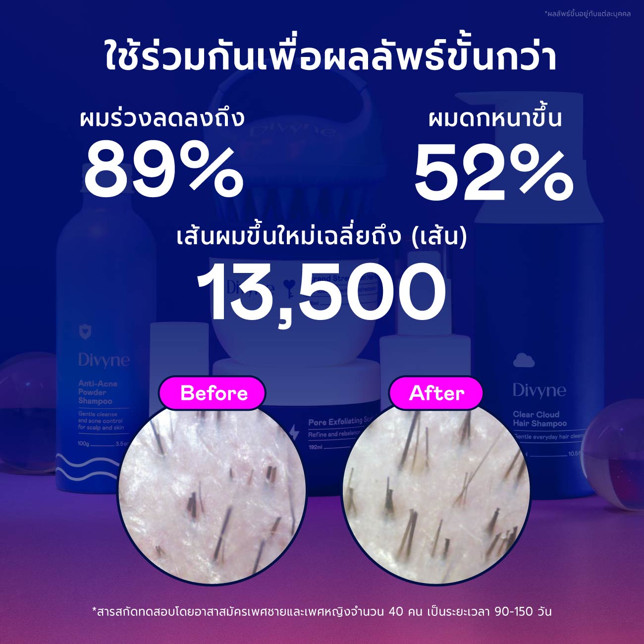 Haircare Ultimate Set