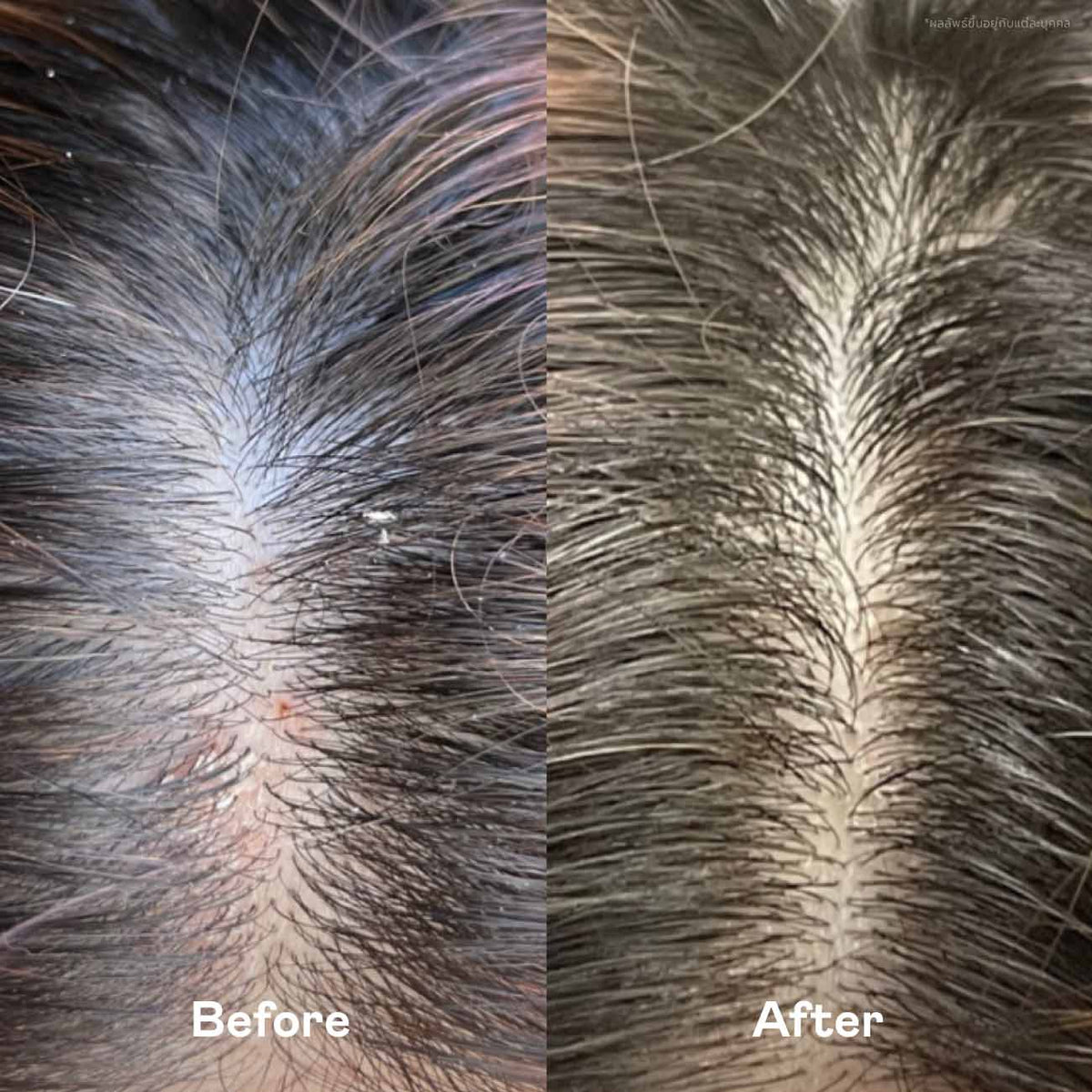 Scalp Balance Duo Set